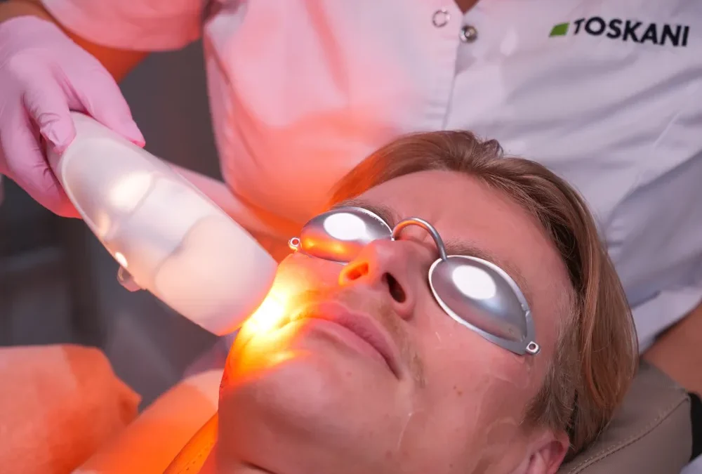 De compacte IPL voor pigmentvlekken: