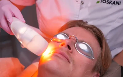 De compacte IPL voor pigmentvlekken: