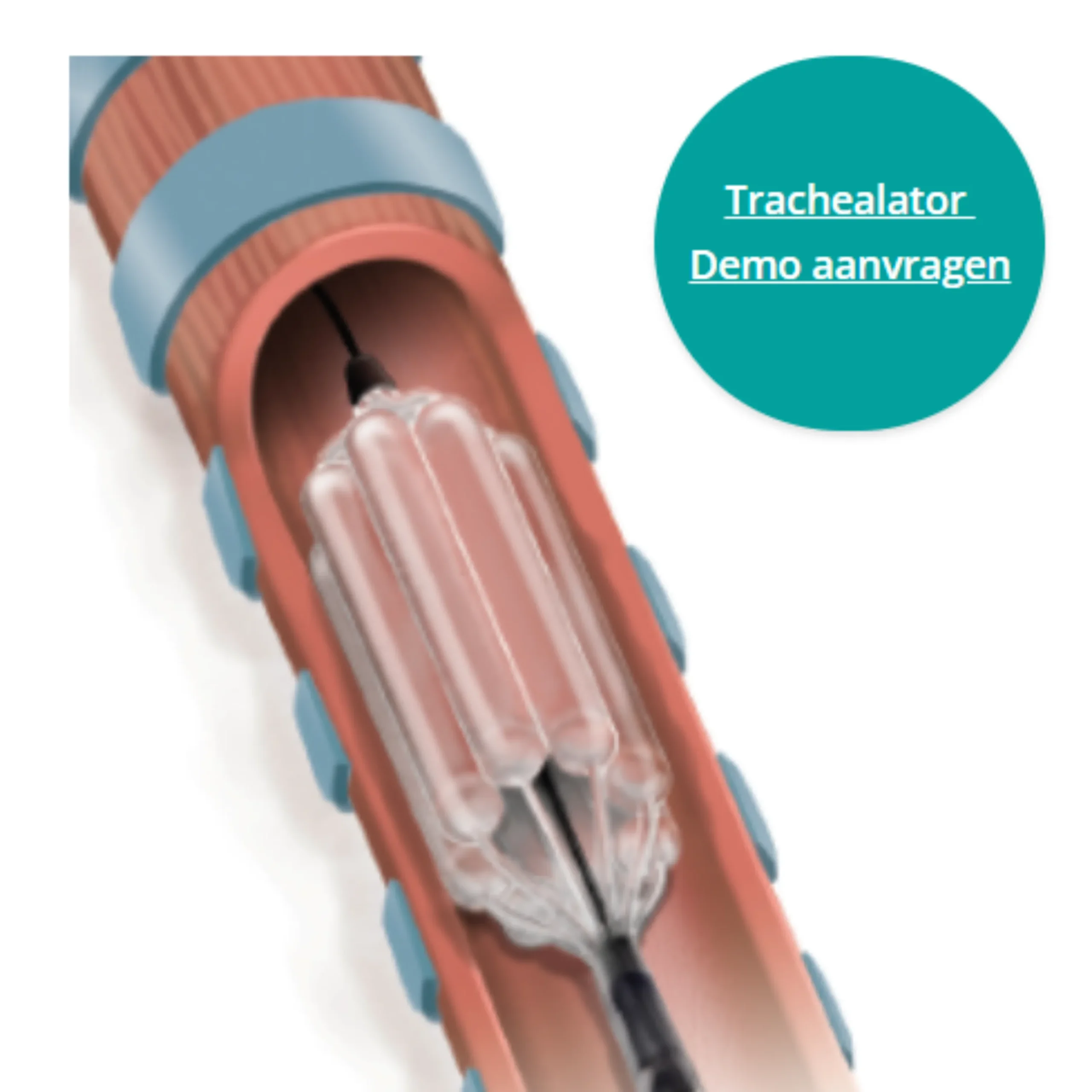 Trachealator